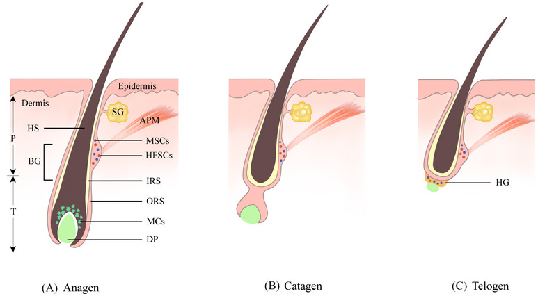 Diagram of the hair follicle showing melanocyte stem cells during anagen, catagen, and telogen phases.