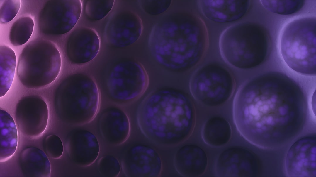 What Are Zombie Cells?